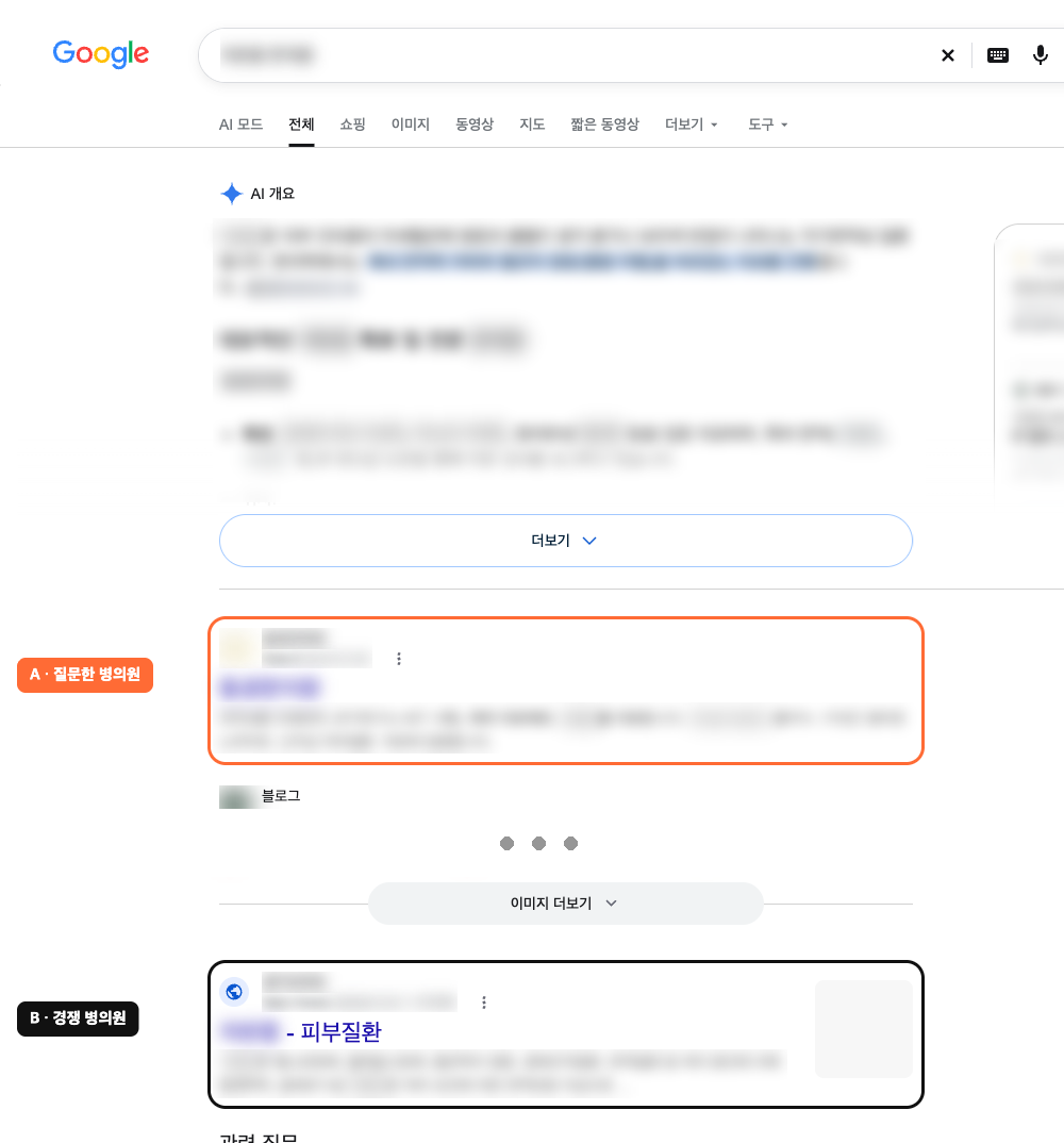구글 검색 결과 화면. 첫 번째 결과에 A 질문한 병의원, 네 번째 결과에 B 경쟁 병의원 표시가 붙어 있다. 병원 이름과 질환명은 흐리게 가려져 있다
